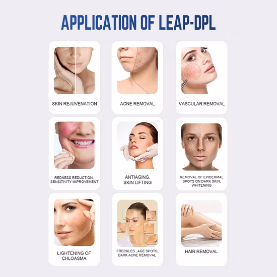 2022 Ice Cooling Hair Removal Machine Intense Pulsed Light Laser Hair Removal Dpl Instrument Skin Rejuvenation Beauty Machine IPL