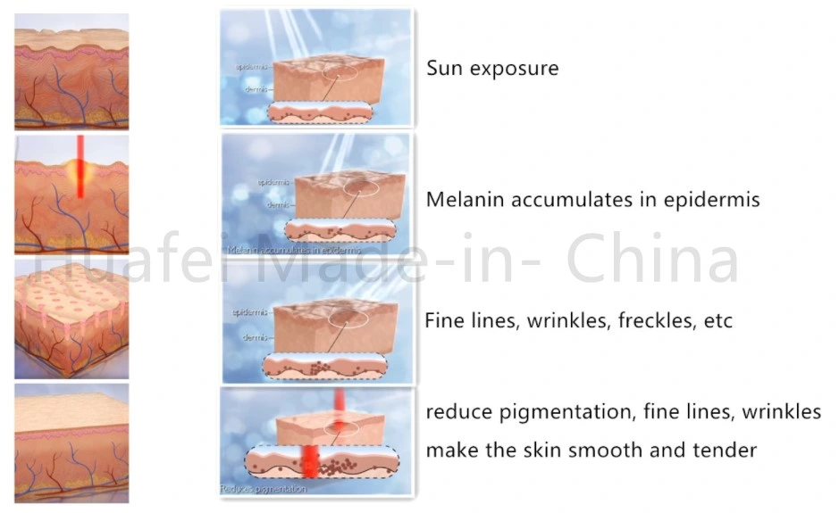 Fractional CO2 Laser Machine Continuous Wave with Efficient Skin Coagulation for Surgical Cut